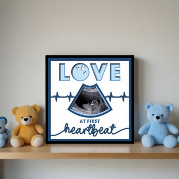 Love at First Heartbeat Frame – Personalised Deep Box Frame for Sonogram / Ultrasound Images